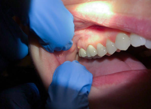 Best Emergency Dentist for Special Needs Patients in Due West, SC