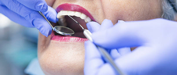 Best Emergency Dentist for Knocked-Out Tooth in Due West, SC